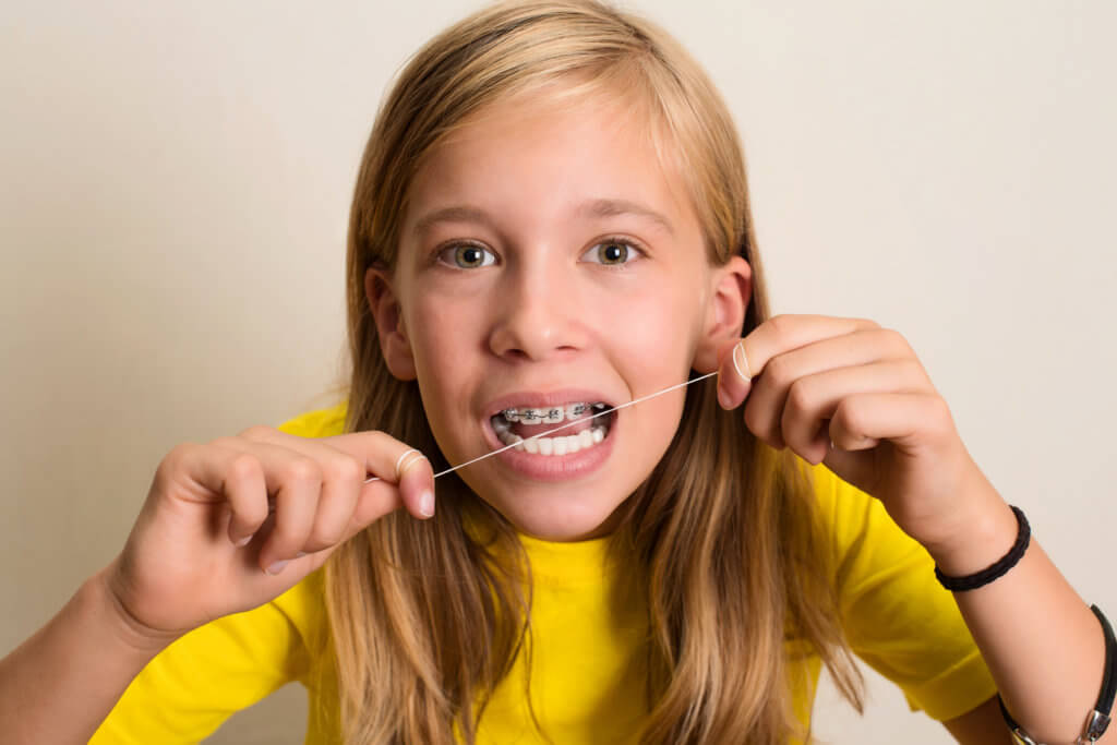 Pediatric smiles - patient with braces flossing