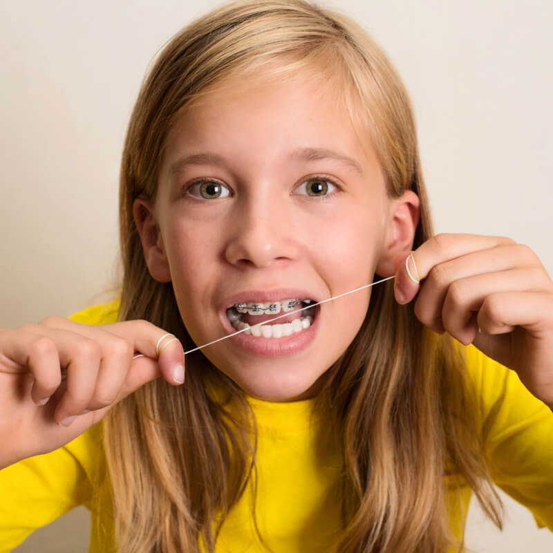 Pediatric smiles - patient with braces flossing